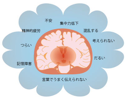 ブレインフォグ★宮城県仙台駅前の漢方相談薬局★仙台薬局におまかせください
