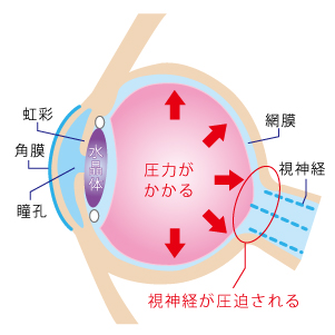 緑内障★仙台薬局